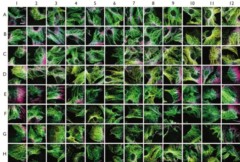 Exemple de criblage de super-résolution sur le cytosquelette de cellules cancéreuses.