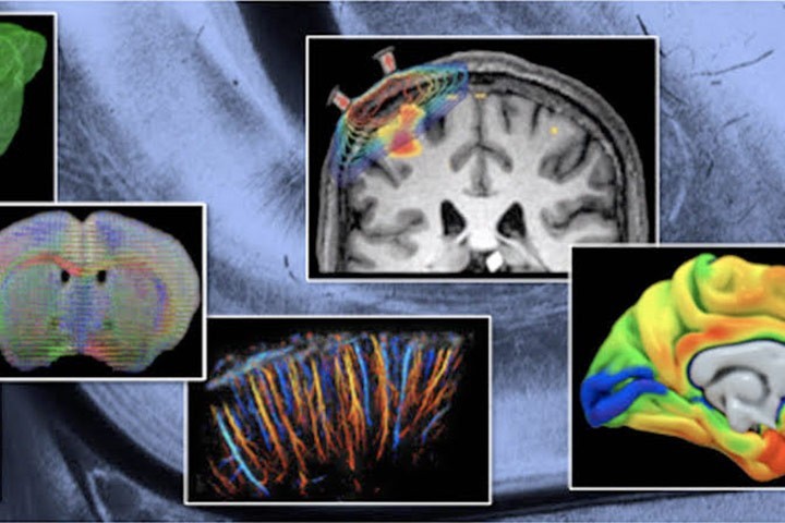 Cajal Course: Whole Brain Imaging