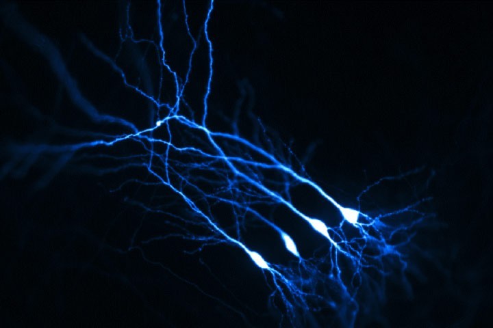 Figure 1 : CA1 neurons in a mouse organotypic hippocampal slice, that were single cell electroporated with TdTomato as a volume marker and observed by confocal microscopy at the Bordeaux Imaging Center.