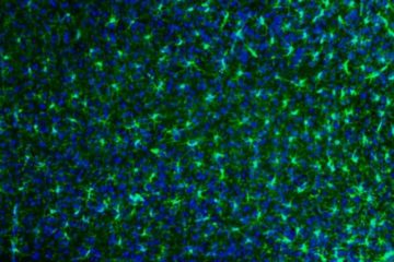 Microglial cells (green) and nuclei from microglial cells and other types of cells including neuronal cells (blue) © INRAE