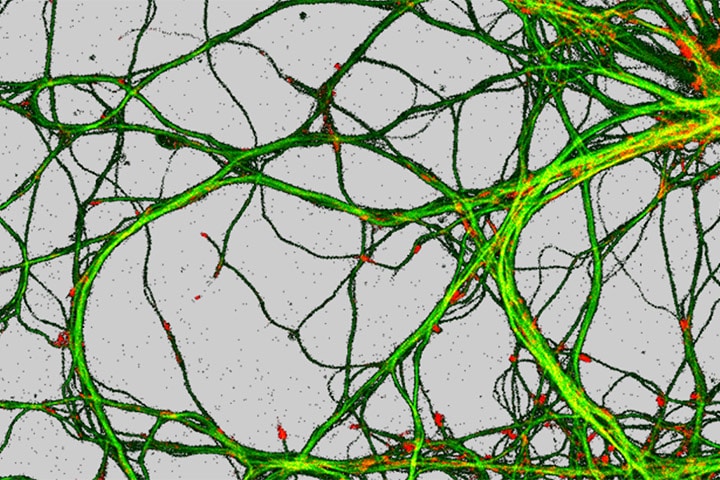 Nano-imagerie corrélative des métaux et des protéines à l’échelle de la synapse