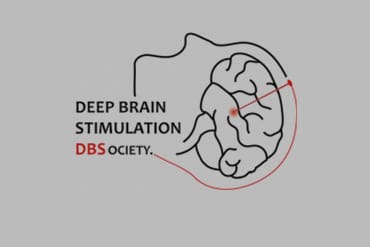 Création de la ＂Deep Brain Stimulation Society＂